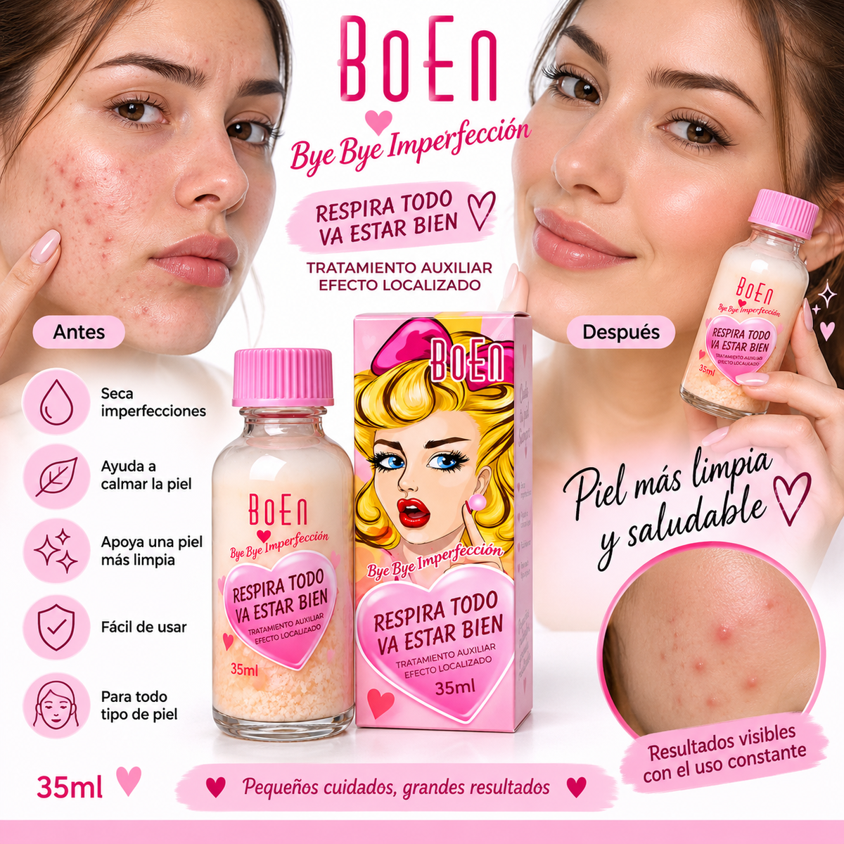 BoEn Bye Bye Imperfección – Tratamiento Auxiliar