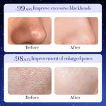 Mascarilla Facial Natural de Colágeno y Carbón Activado